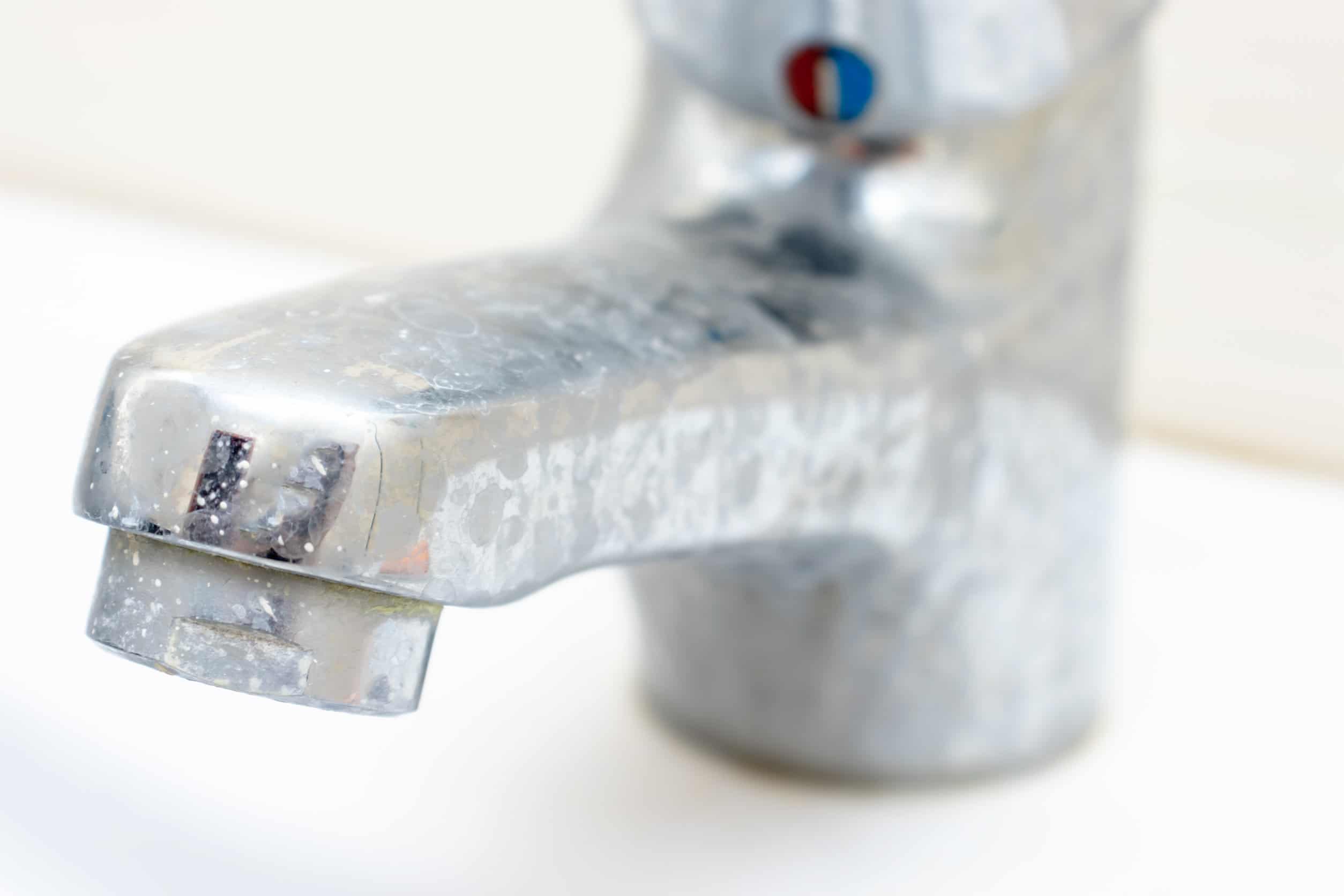 6 Signs You Need A Water Softener